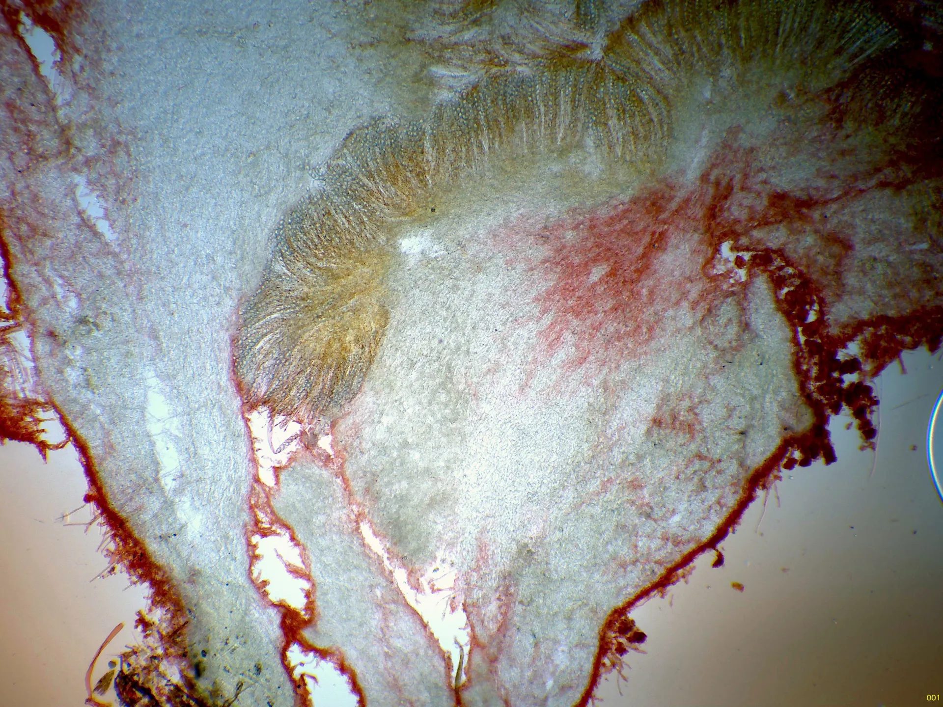 Microscopía de Neottiella rutilans - 11 - Sección a 40 aumentos-001